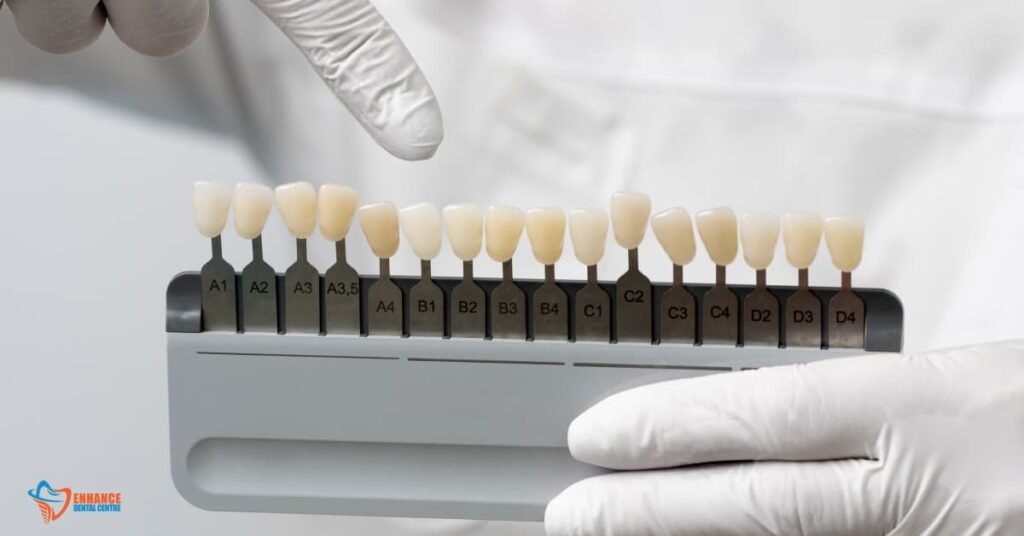 A Full Guide to Dental Glue for Crowns Enhance Dental CA