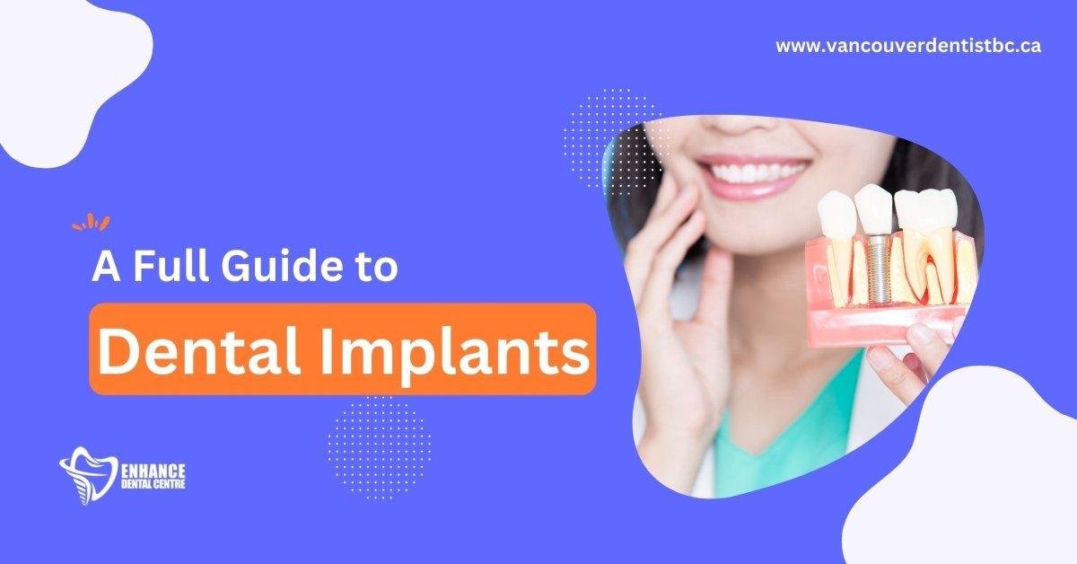 A Full Guide to Dental Implants + Before & After Photos Enhance Dental CA