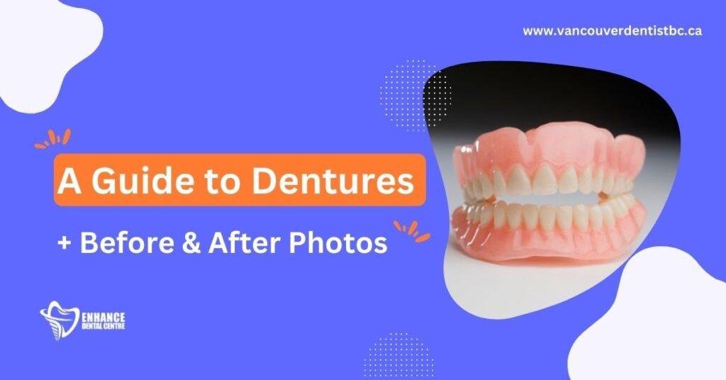 A Guide to Dentures + Before & After Photos Enhance Dental CA