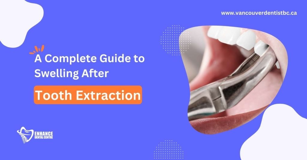 Swelling After Tooth Extraction (Causes, Treatments, and Essential Tips)